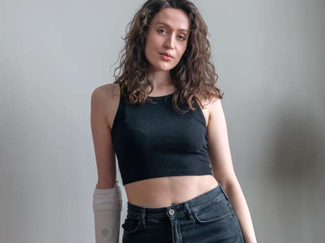 Lara is a curly-haired brunette female wearing all black. She has a white prosthetic arm and is standing against a grey backdrop.